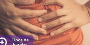 consejos para sobrellevar una hernia inguinal