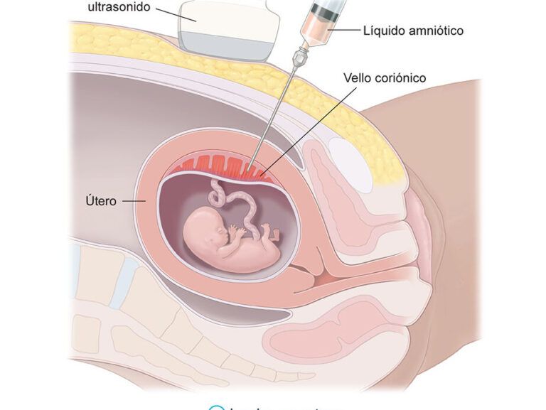 Detecta la pérdida de líquido amniótico: Consejos para saber cómo hacerlo