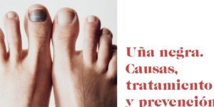 mancha oscura en una de pie causas y tratamientos
