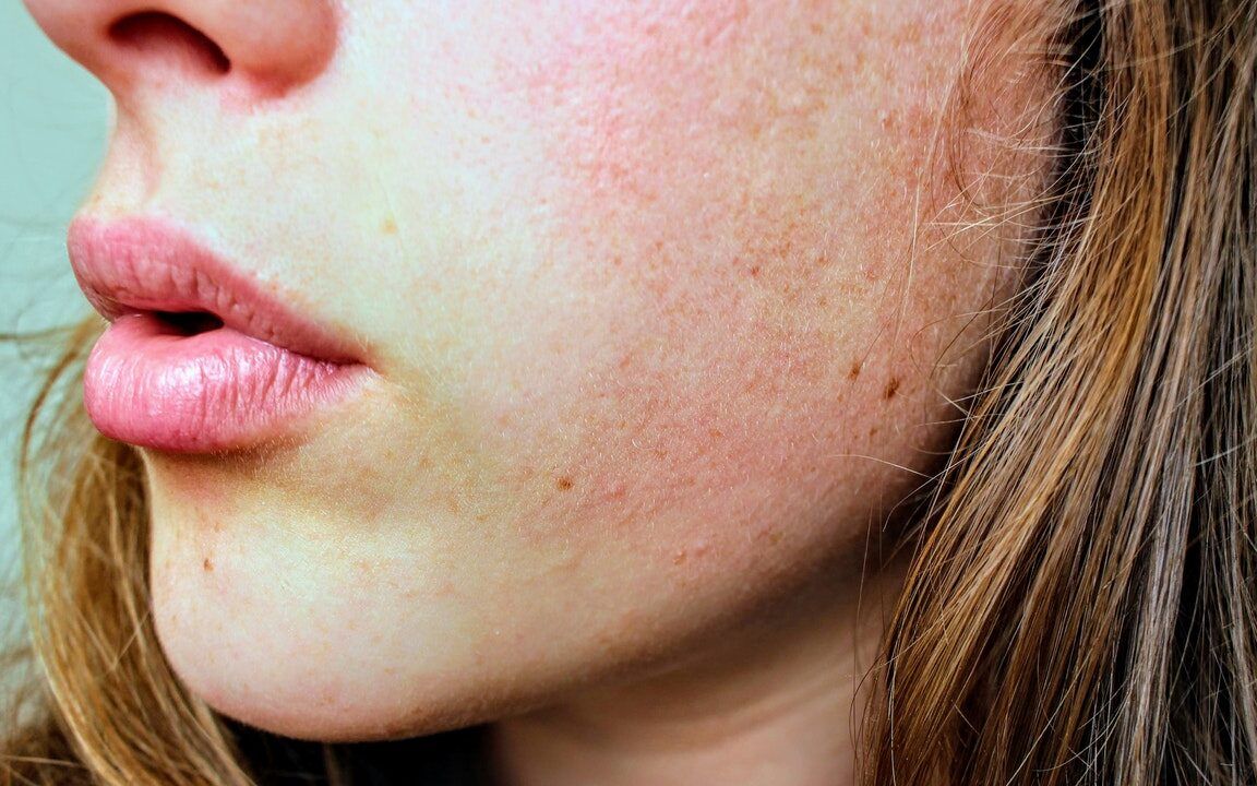 sudoracion nocturna en el cuello causas y soluciones
