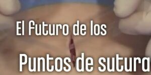 tratamiento para cortes profundos sin necesidad de puntos de sutura