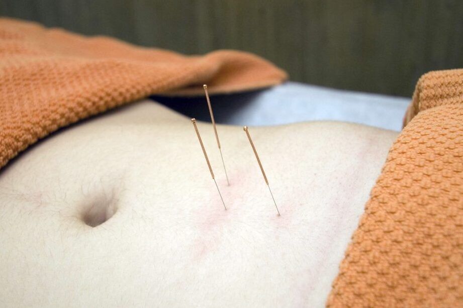 acupresion estomacal efectiva