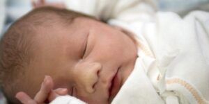 bebe con ictericia