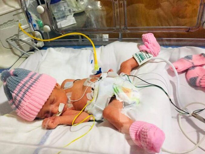 bebe prematuro en incubadora