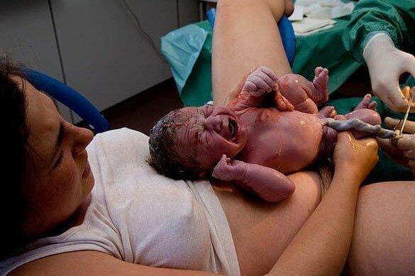 cordon umbilical en accion