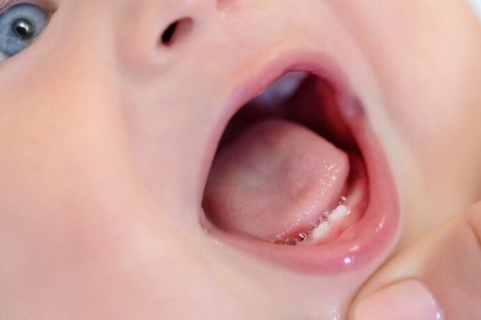 dientes de bebes emergiendo