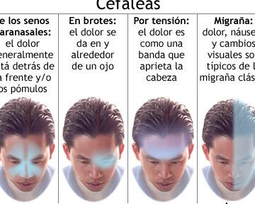 dolor de cabeza y mareo