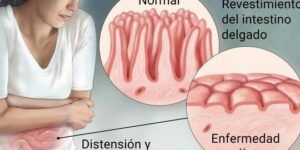 enfermedad celiaca
