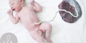 fotografia del cordon umbilical
