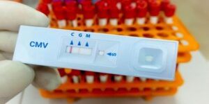 igg positivo cmv informacion relevante
