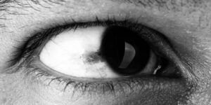 ojo con mancha negra