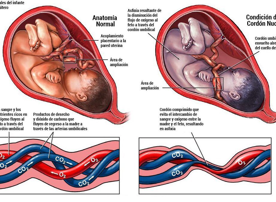 patron de tejido perinatal