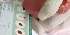 prueba del talon beneficios para bebes