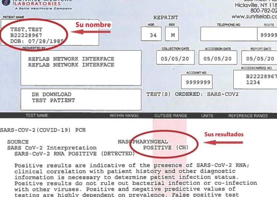 resultados de prueba covid 19