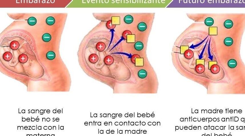 rh positivo y embarazo