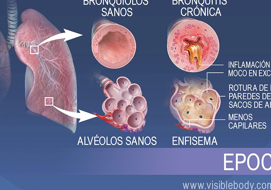 sintomas respiratorios comunes