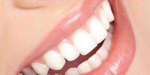 sonrisa saludable