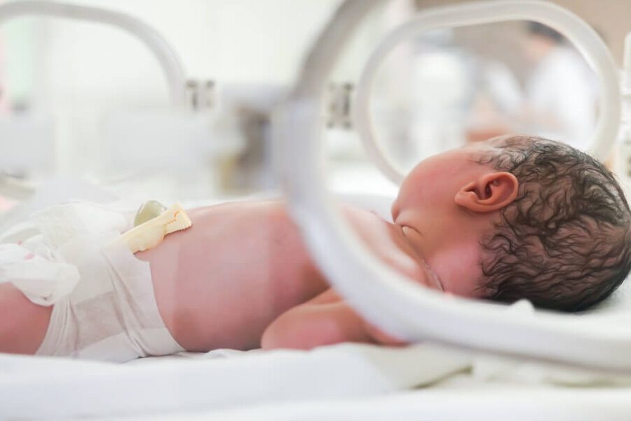 bebe prematuro en incubadora