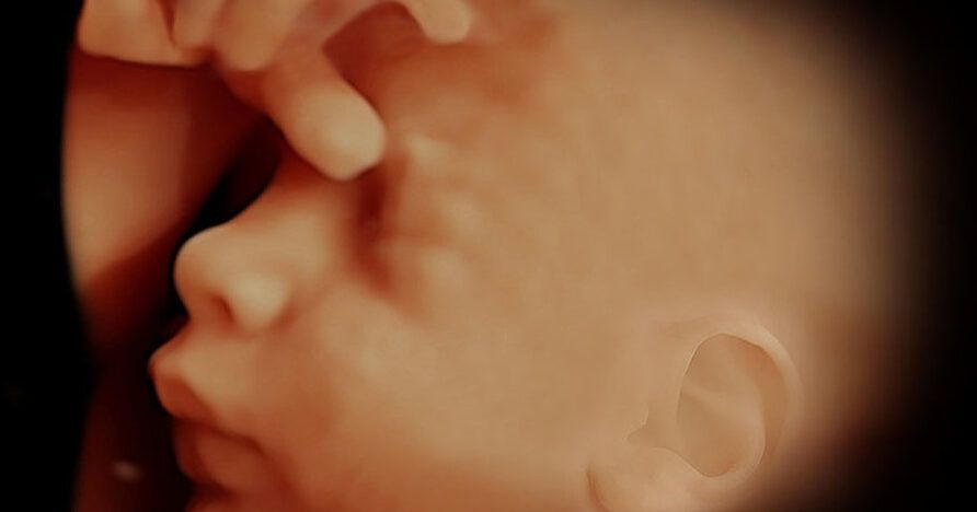 embarazo tras aborto por malformacion