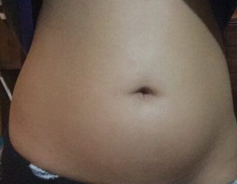 diferencias entre embarazo y gordura