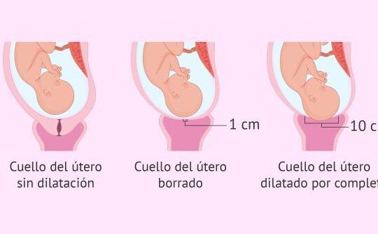 efectos borrado cuello uterino
