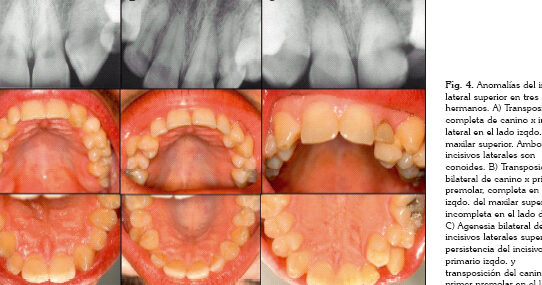 anomalias dentales en la infancia