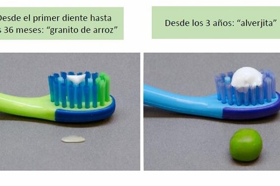 aplicacion de fluor en dientes de leche