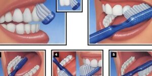 cepillado adecuado y higiene bucal