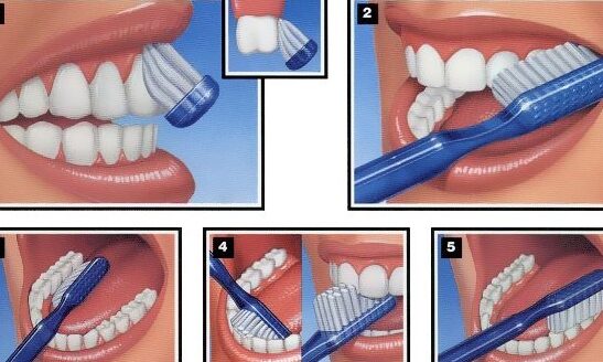 cepillado adecuado y higiene bucal