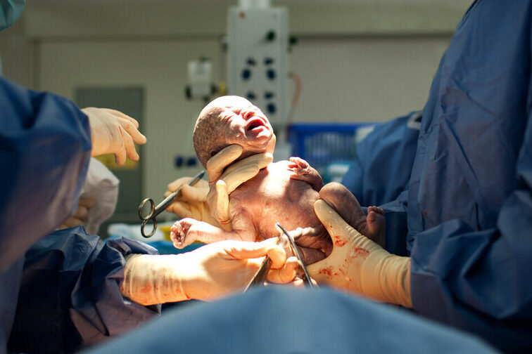 cesarea programada preparacion y procedimiento