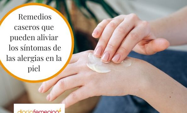 consejos para prevenir alergias en la piel
