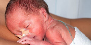 cuidado de la piel en bebes prematuros