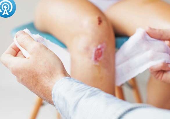 cuidados para cicatrizacion en ninos