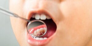 dientes temporales y cuidado dental