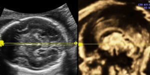 ecografias especializadas para bienestar fetal
