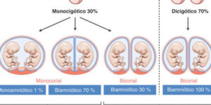 embarazos multiples y consideraciones importantes