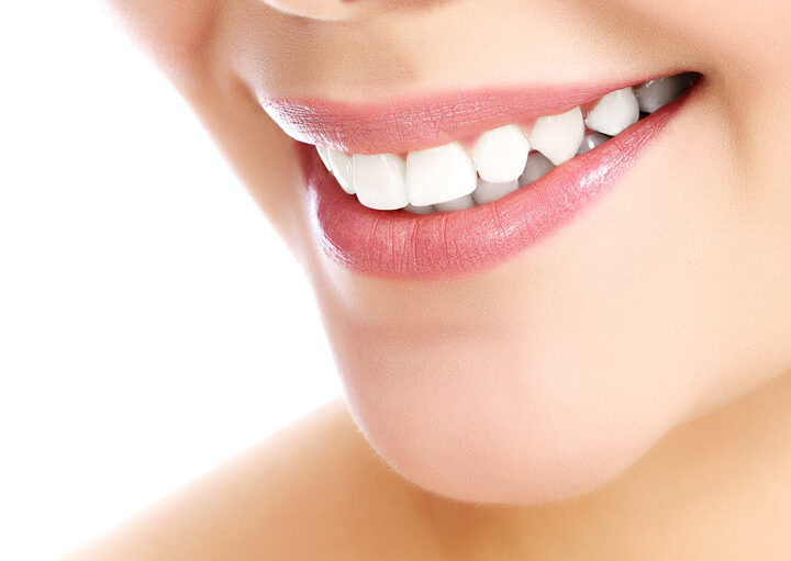 empastes esteticos para ninos sonrisa saludable