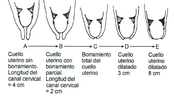 etapas y proceso de dilatacion