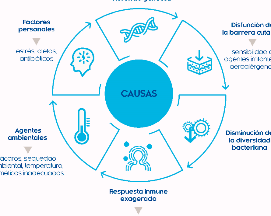 factores desencadenantes de dermatitis atopica