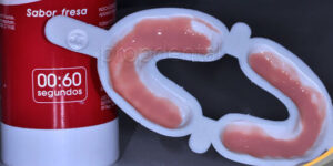 fluoruro para prevenir caries dentales