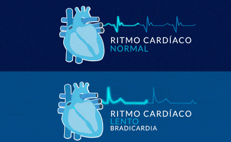 frecuencia cardiaca y taquicardia