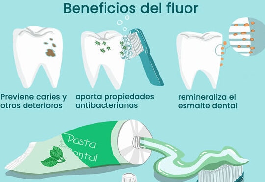 importancia de la fluorizacion en odontologia