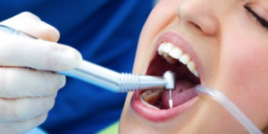 importancia de la limpieza dental