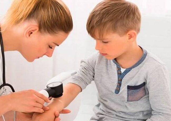 importancia de revision dermatologica en ninos