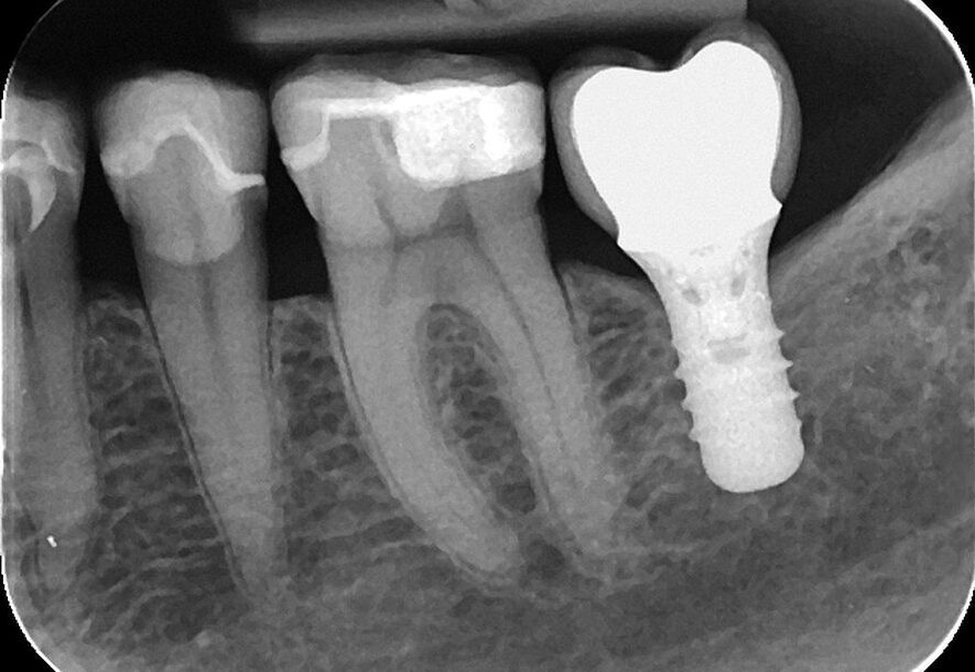 innovaciones en radiografias dentales para ninos