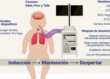 monitoreo durante anestesia en ninos