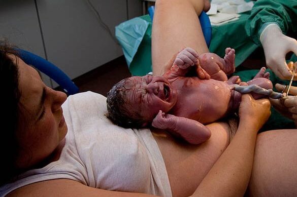 mujer dando a luz sin dolor