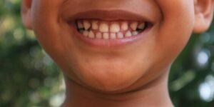 ninos con dientes sanos y sonrientes