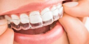 proteccion duradera para dientes de leche