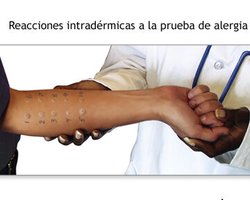 pruebas cutaneas para diagnostico de alergias